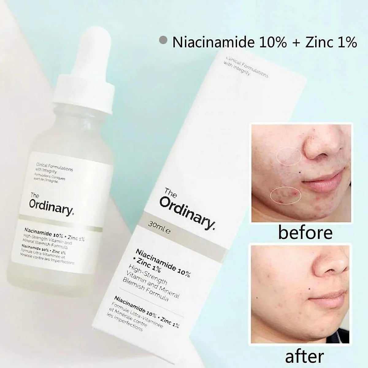The Ordinary Niacinamide 10% + zinc 1%
